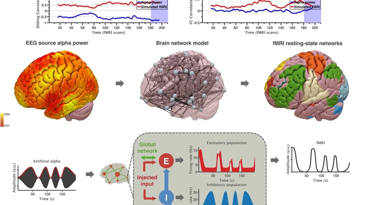 brain network