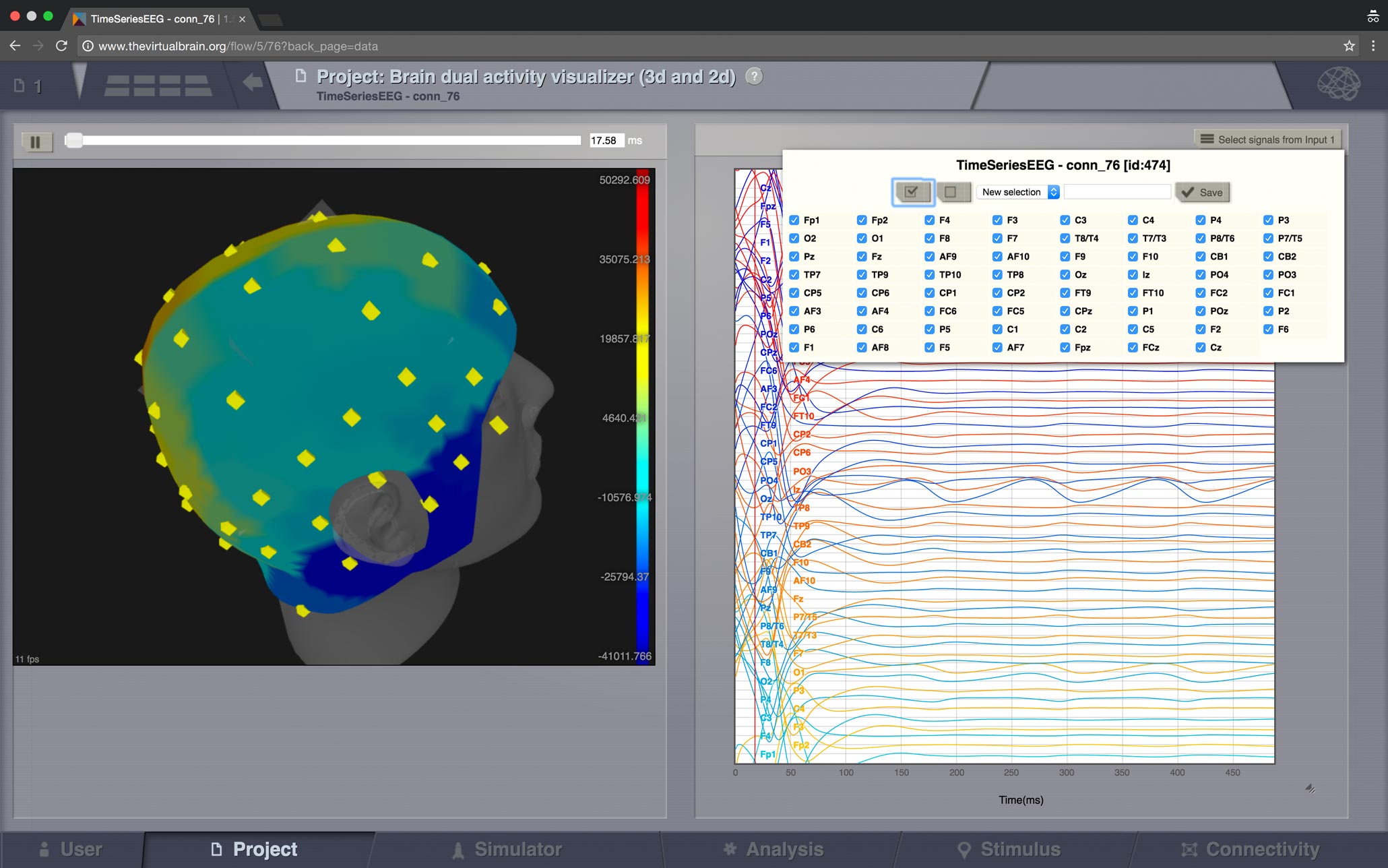 ViewBrainActivity_EEG.jpg