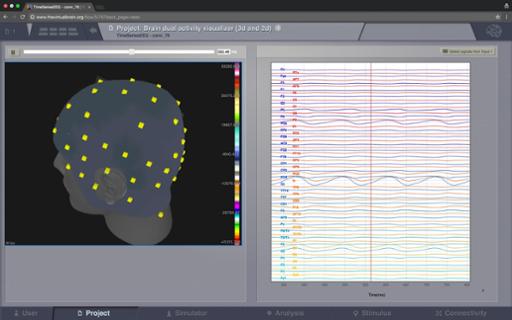 ViewBrainActivity_EEG2.jpg