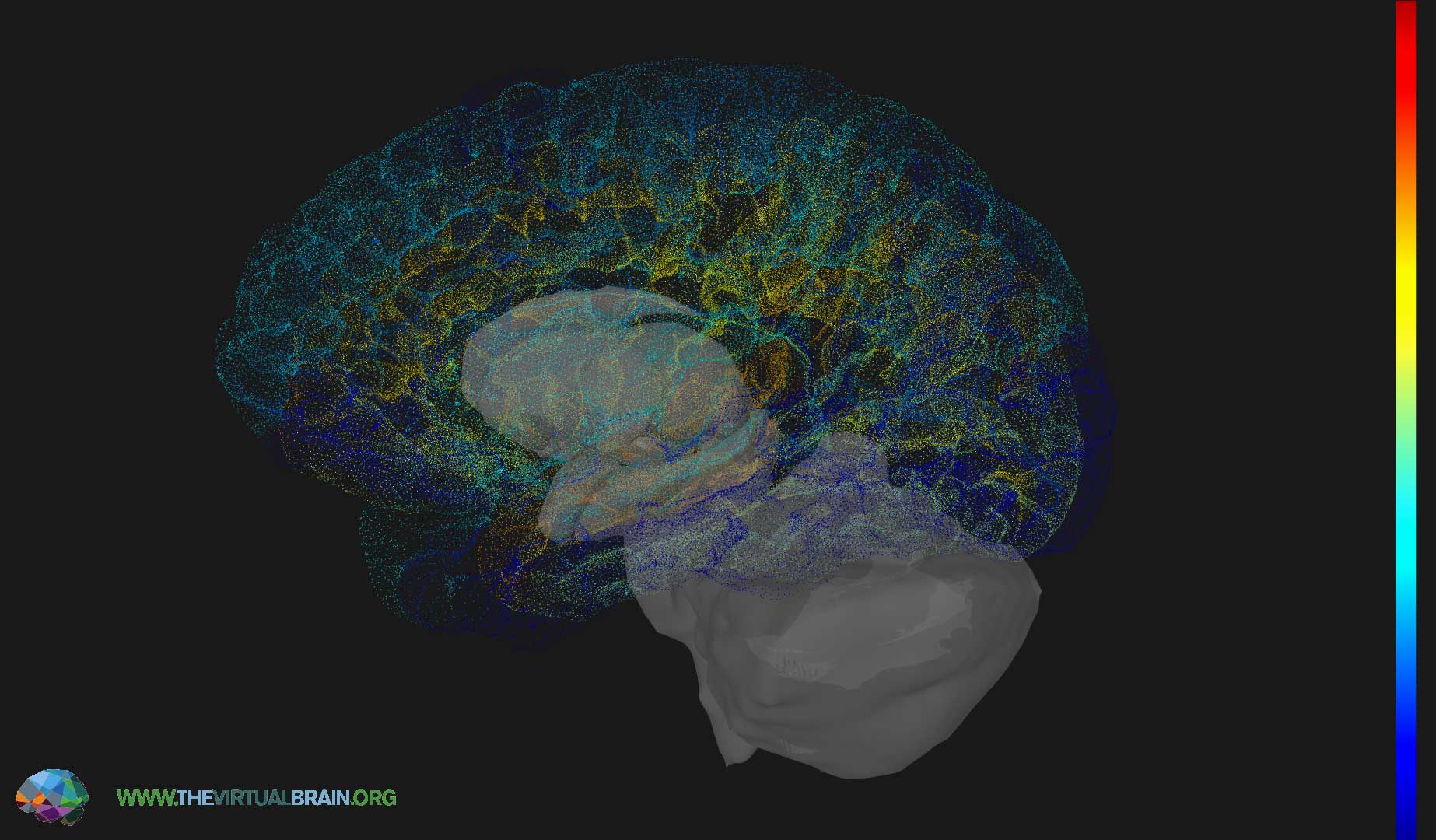 TVB-brain-front-1.jpg