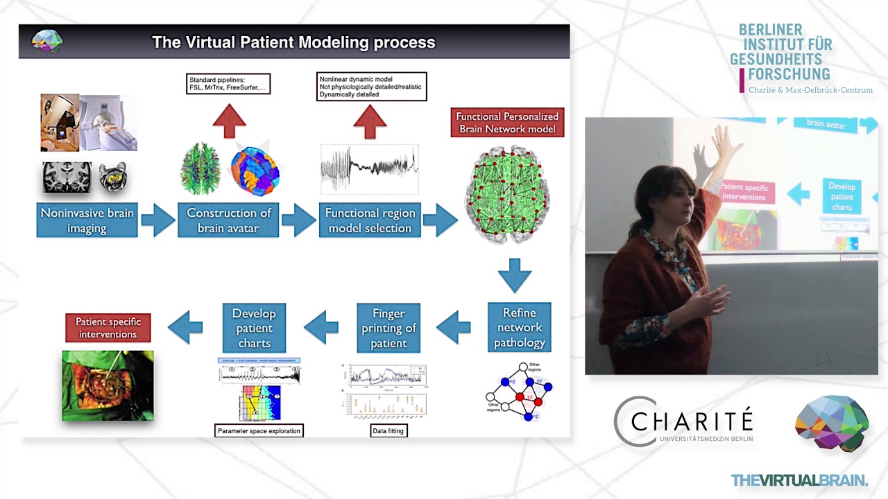 VIDEO: Modelling Epilepsy with The Virtual Brain