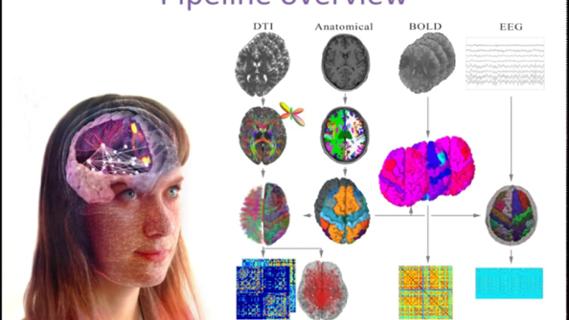 VIDEO: An automated pipeline for constructing personalized virtual brains from multimodal neuroimaging data