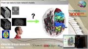 VIDEO: Generating Virtual Brain ready imaging data