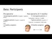 VIDEO: Modeling brain dynamics in brain tumor patients using The Virtual Brain
