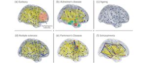 AdvancingNeurosciencewithPersonalisedBrainModels.jpg